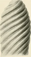Picture 49 of 72 from Surgery of the lung / by C. Garrè and H. Quincke. (1913), leaf 175