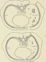 Picture 50 of 72 from Surgery of the lung / by C. Garrè and H. Quincke. (1913), leaf 184