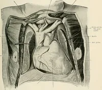 An illustration from Surgery of the lung / by C. Garrè and H. Quincke. (1913)