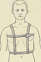 An illustration from Surgery of the lung / by C. Garrè and H. Quincke. (1913)