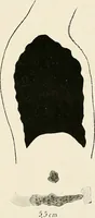 Picture 67 of 72 from Surgery of the lung / by C. Garrè and H. Quincke. (1913), leaf 261
