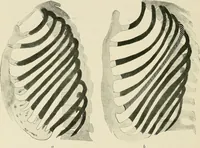Picture 68 of 72 from Surgery of the lung / by C. Garrè and H. Quincke. (1913), leaf 264