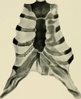 Picture 70 of 72 from Surgery of the lung / by C. Garrè and H. Quincke. (1913), leaf 266