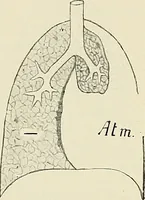 Picture 10 of 72 from Surgery of the lung / by C. Garrè and H. Quincke. (1913), leaf 40