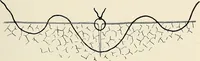 Picture 33 of 72 from Surgery of the lung / by C. Garrè and H. Quincke. (1913), leaf 85