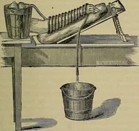 An illustration from Modern surgery, general and operative / by John Chalmers DaCosta. (1914)