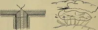 An illustration from Modern surgery, general and operative / by John Chalmers DaCosta. (1914)