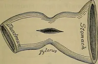 An illustration from Modern surgery, general and operative / by John Chalmers DaCosta. (1914)