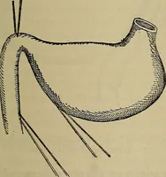 An illustration from Modern surgery, general and operative / by John Chalmers DaCosta. (1914)