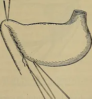 An illustration from Modern surgery, general and operative / by John Chalmers DaCosta. (1914)