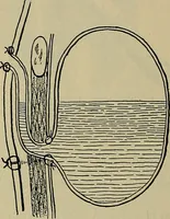An illustration from Modern surgery, general and operative / by John Chalmers DaCosta. (1914)