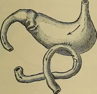 An illustration from Modern surgery, general and operative / by John Chalmers DaCosta. (1914)
