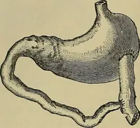 An illustration from Modern surgery, general and operative / by John Chalmers DaCosta. (1914)