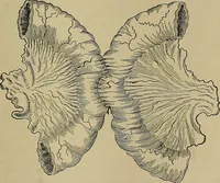 An illustration from Modern surgery, general and operative / by John Chalmers DaCosta. (1914)