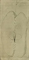 An illustration from Modern surgery, general and operative / by John Chalmers DaCosta. (1914)