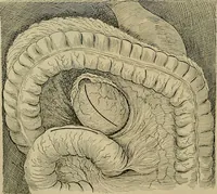 An illustration from Modern surgery, general and operative / by John Chalmers DaCosta. (1914)