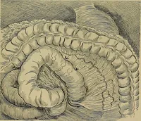 An illustration from Modern surgery, general and operative / by John Chalmers DaCosta. (1914)