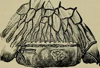 An illustration from Modern surgery, general and operative / by John Chalmers DaCosta. (1914)