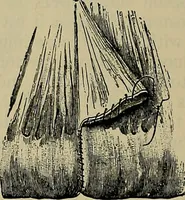 An illustration from Modern surgery, general and operative / by John Chalmers DaCosta. (1914)