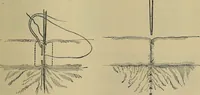 An illustration from Modern surgery, general and operative / by John Chalmers DaCosta. (1914)