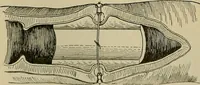 An illustration from Modern surgery, general and operative / by John Chalmers DaCosta. (1914)