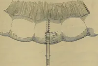 An illustration from Modern surgery, general and operative / by John Chalmers DaCosta. (1914)