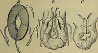 An illustration from Modern surgery, general and operative / by John Chalmers DaCosta. (1914)