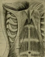An illustration from Modern surgery, general and operative / by John Chalmers DaCosta. (1914)