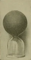 An illustration from Modern surgery, general and operative / by John Chalmers DaCosta. (1914)