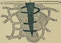 An illustration from Modern surgery, general and operative / by John Chalmers DaCosta. (1914)