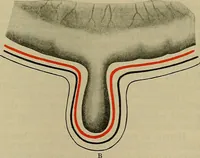 An illustration from Modern surgery, general and operative / by John Chalmers DaCosta. (1914)