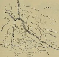 An illustration from Modern surgery, general and operative / by John Chalmers DaCosta. (1914)