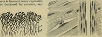 An illustration from Modern surgery, general and operative / by John Chalmers DaCosta. (1914)