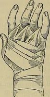 An illustration from Modern surgery, general and operative / by John Chalmers DaCosta. (1914)