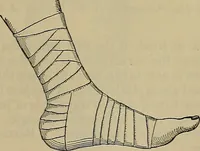 An illustration from Modern surgery, general and operative / by John Chalmers DaCosta. (1914)