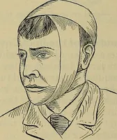 An illustration from Modern surgery, general and operative / by John Chalmers DaCosta. (1914)