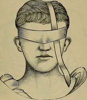 An illustration from Modern surgery, general and operative / by John Chalmers DaCosta. (1914)