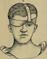 An illustration from Modern surgery, general and operative / by John Chalmers DaCosta. (1914)
