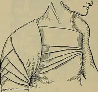 An illustration from Modern surgery, general and operative / by John Chalmers DaCosta. (1914)