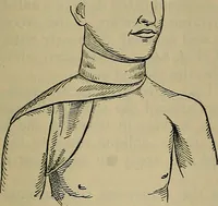An illustration from Modern surgery, general and operative / by John Chalmers DaCosta. (1914)