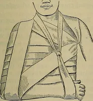 An illustration from Modern surgery, general and operative / by John Chalmers DaCosta. (1914)