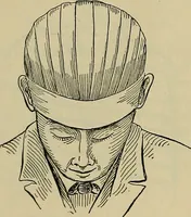 An illustration from Modern surgery, general and operative / by John Chalmers DaCosta. (1914)