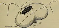 An illustration from Modern surgery, general and operative / by John Chalmers DaCosta. (1914)