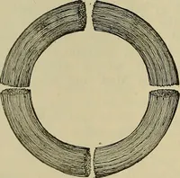 An illustration from Modern surgery, general and operative / by John Chalmers DaCosta. (1914)