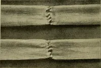 An illustration from Modern surgery, general and operative / by John Chalmers DaCosta. (1914)