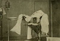 An illustration from Modern surgery, general and operative / by John Chalmers DaCosta. (1914)