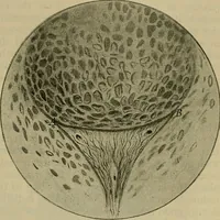 An illustration from Modern surgery, general and operative / by John Chalmers DaCosta. (1914)