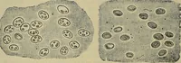 An illustration from Modern surgery, general and operative / by John Chalmers DaCosta. (1914)