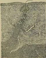 An illustration from Modern surgery, general and operative / by John Chalmers DaCosta. (1914)