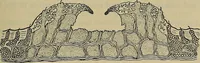 An illustration from Modern surgery, general and operative / by John Chalmers DaCosta. (1914)